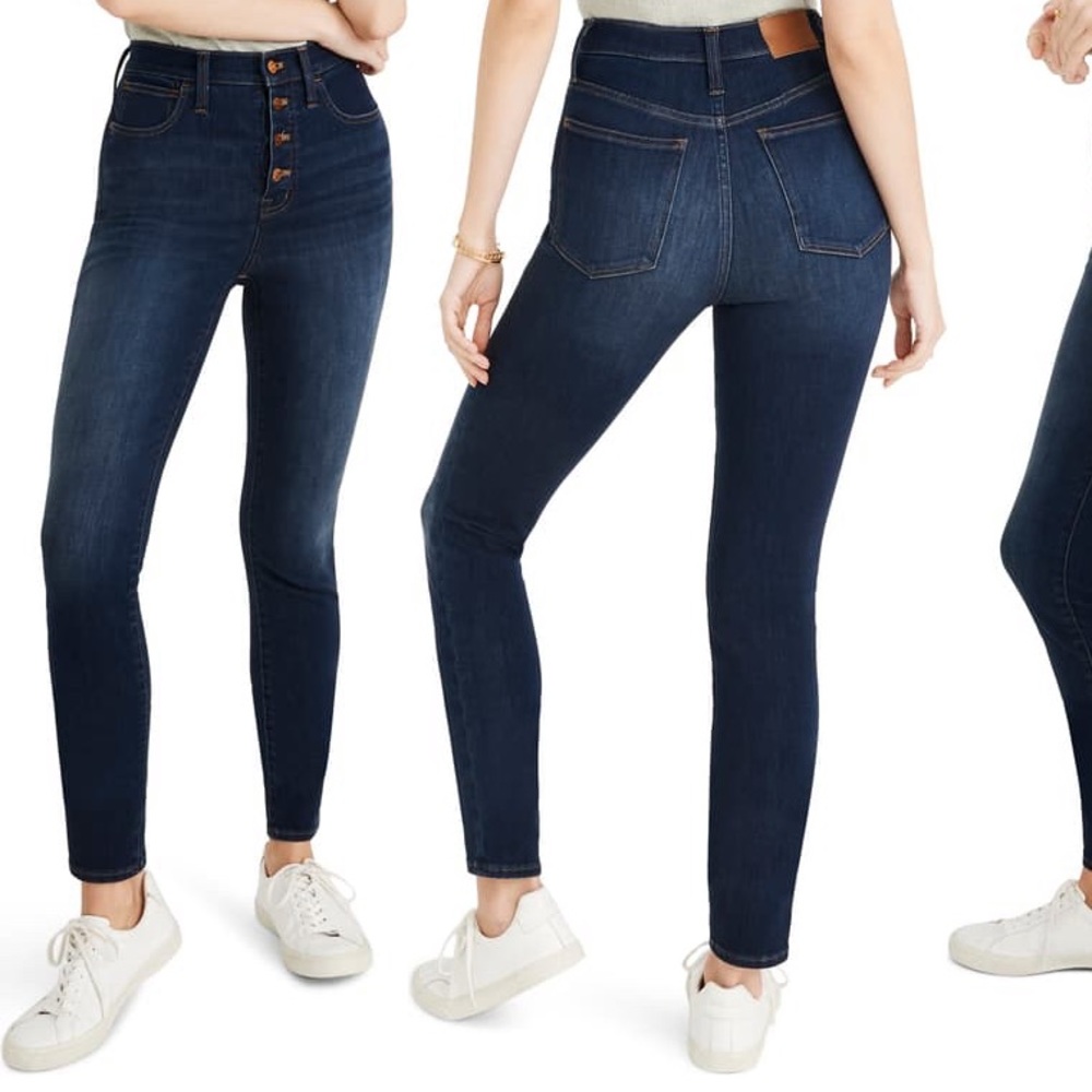 Madewell button front skinny jeans
